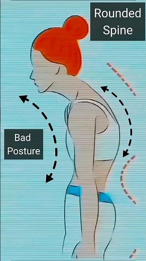 Exercise for Rounded Upper Back Spine #Hunch Back (Improve your Posture)