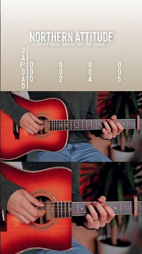 Northern Attitude Noah Kahan Guitar Tutorial // Northern Attitude Guitar Lesson