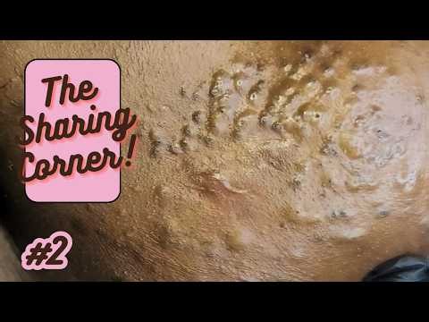 The Sharing Corner +#2
