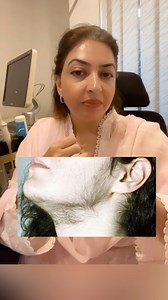 24K views · 442 reactions | PCOS Symptoms | #pcos #polycysticovarysyndrome #females #pregnancy #cutebaby | Dr. Rohina Gul - Clincial Sexologist & Fertility Specialist | Facebook
