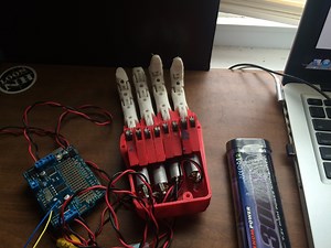 Cost Effective Prosthetic Hand  | RobotShop Community
