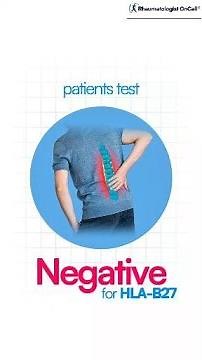 Negative HLA-B27 Does NOT Rule Out Ankylosing Spondylitis — What You Need to Know