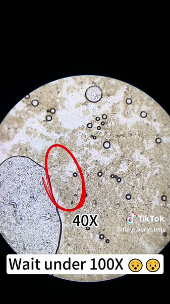 Exploring the Fascinating World of Fish Oil Under a Microscope