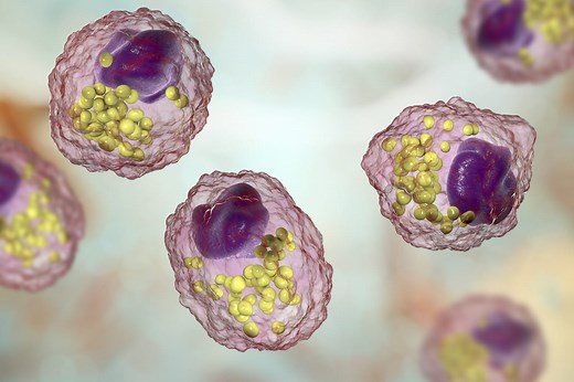 Dyslipidémie : c'est quoi, trop de lipides, que faire ?