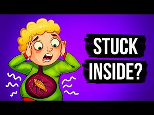 What If You Swallowed a Live Cockroach?