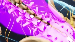 4.9K views · 25 reactions | Considering a surgery for your herniated disc? See this quick video on how a microdiscectomy is done. Watch the full video: https://www.spine-health.com/video/lumbar-microdiscectomy-surgery-video | Spine-health | Facebook