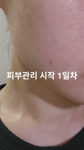 자기관리 피부분야로,,,,대만여행때 쟁여둔 디페린겔 드디어 시작합니다. 피부과 유튜브 보고 자극받아 꺼냈는데 과연 얼마나 달라질지...