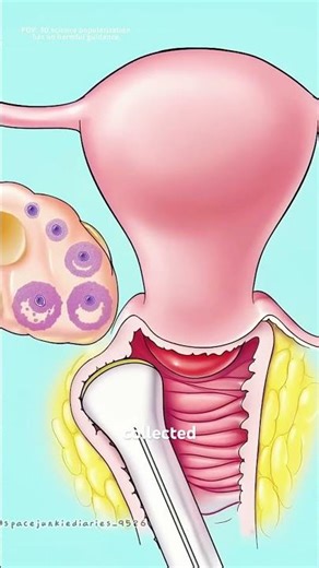 Test tube baby (In vitro fertilization) #drone #theflash #space #automobile #rocketscience