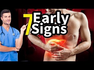 7 Alarming Signs of a Damaged Liver | Liver Disease Symptoms