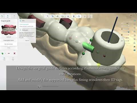 3Shape Unite Implant Studio 2022: Detailed Workflow