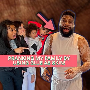 I Glued My Skin To PRANK My Family 🤣 | Daddy Dlo TV