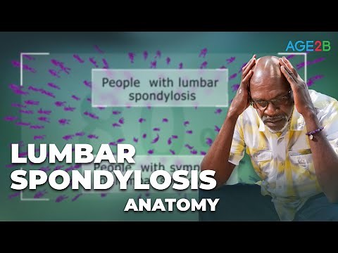 Lumbar Spondylosis, Spondylolysis, & Spondylolisthesis (Lumbar Spine) How is Spondylosis treated?