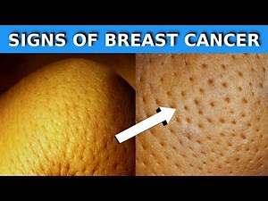 15 Warning Signs Of Breast Cancer You Shouldn't Ignore