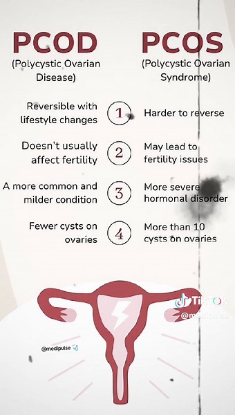 PCOS vs PCOD🩺 #foryoupagе #information #medical #doctor #genralknowledge #creatorsearchinsights #growth #blessings