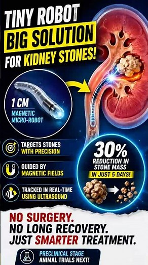 Tiny Robot Destroys Kidney Stones in Days! No Surgery Needed! #MedicalBreakthrough #FutureOfMedicine