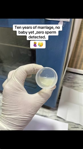 41 years old male semen analysis 😥#semenalysis #fertility #fertilityawareness #fyp #viralvideo