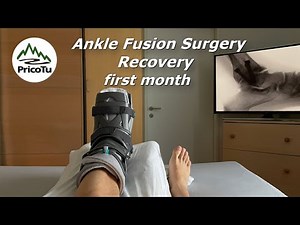 My Ankle Fusion Recovery - first month