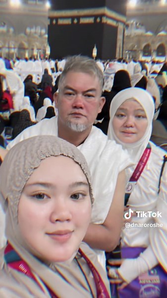 Rest Face Expressions: Chill vs. Garang