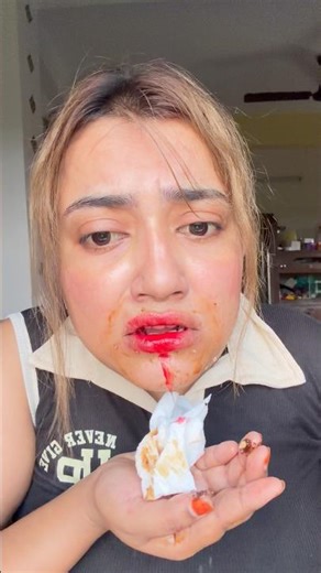 ঠোঁট 👄 কেটে গেলো 🩸😭🤯 #bengali #shorts #viralshorts #trending #viral #minivlog #funnyvideo #hack #lol