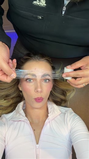 Effective Ways to Manage Acne and Enhance Eyebrow Shape