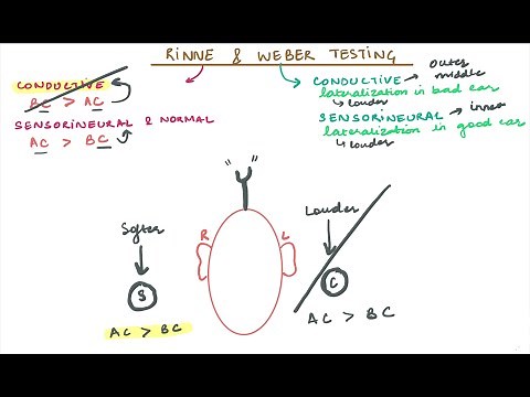 Rinne & Weber Testing