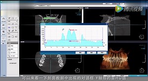 Ondemand 3D基本功能