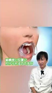 "Indirect bonding" using a plaster model for wire orthodontics #OsakaOrthodonticsGroup #WireOrtho...