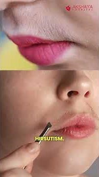 Hirsutism: Symptoms, causes, diagnosis, and treatment #health #tips #pcos