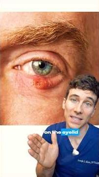 Never Put This in Your Eyes #eyecare #doctor #shorts