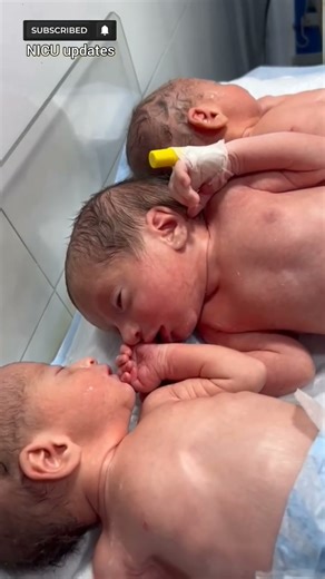 Triplets Receiving Special Care in the NICU | Multiple Birth Journey #multiplebirths
