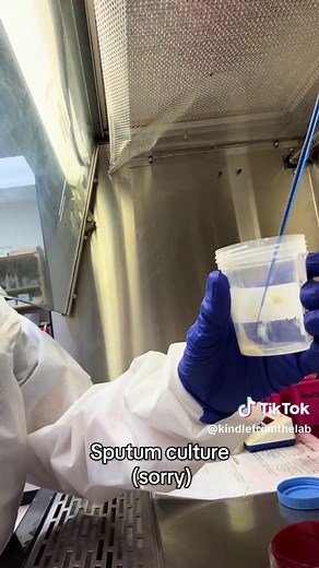 Understanding Sputum Cultures in Microbiology