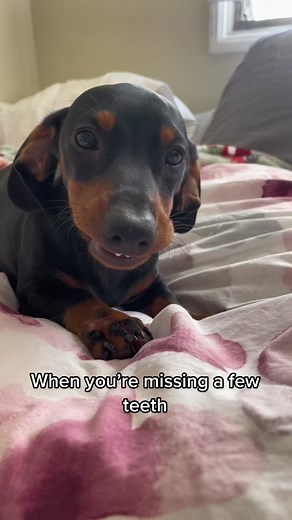 Dachshund Puppy with Missing Teeth Smiles Brightly | Funny Dog Video