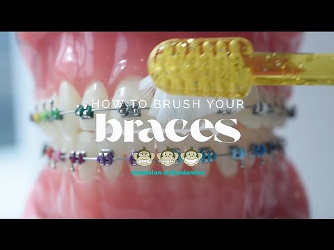 How To Brush Your Braces