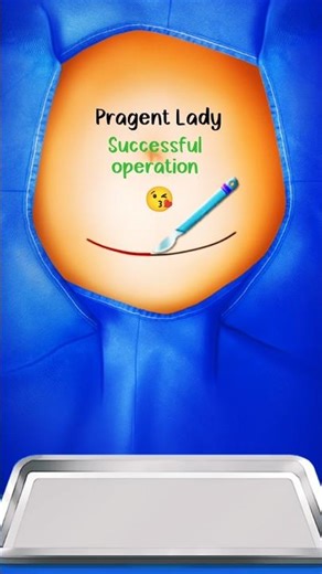 Pragent Lady Operation Game || #hospitalgame #trendingshorts