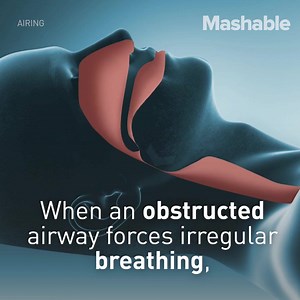 This ingenious device will help 22 million Americans who suffer from a terrifying sleep disorder | Mashable