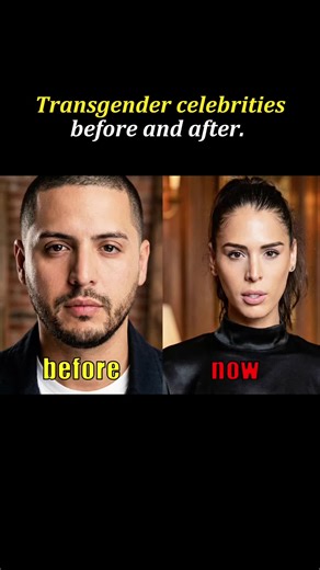 Transgender Celebrities: Before and After