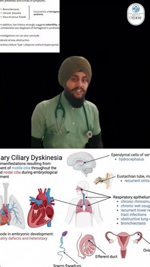 Kartagener’s syndrome #medmint #medicine #medicalstudent #clinicalcases #education #medlife