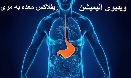 در این ویدیو بیماری و حالت ریفلاکس معده به مری را به شکل انیمیشن تصویری برای شما آماده ساخته و تشریح کرده ایم تا خوبتر بدانیدکه این حالت چگونه صورت می گیرد. 👇 | Dr Naweed Khpulwak