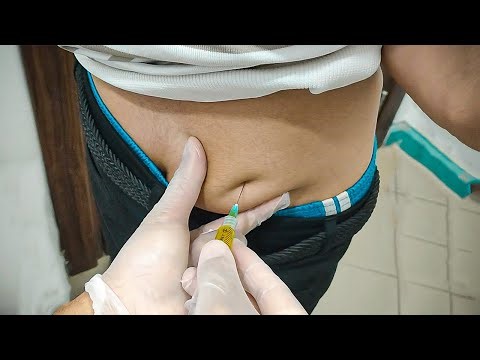 حقنة عضل لشابة مصرية فى البيت & Intramuscular injection for ayoung man at home