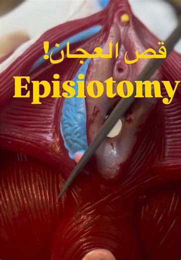 ⁨\t⁨\tسمعتي عن قص العجان✂️ قبل كدة؟ شاركينا تجربتك في التعليقات، ولو عندك سؤال سيبيهولي تحت👇🏻 أنا د. أفنان، أخصائية الصحة النسائية واضطرابات قاع الحوض 🤍 بقدّم محتوى متخصص عن صحة قاع الحوض والصحة النسائية وصحة الأم قبل وبعد الولادة 🌸 ما تنسيش المتابعة، وشاركي المعلومة مع غيرك علشان الفايدة توصل للكل 📲✨ ولو حابة تعيشي الولادة بقوة واطمئنان، وتدعمي نفسكِ وبيبيكِ من أول لحظة 🤱✨ احجزي مكانكِ في ورشة تحضير الولادة 🌸 سيبي تعليق بكلمة “ولادة” 👇⁩ ‏#doulasupport #صحة_المرأة #قاع_الحوض #SkinToSkin 