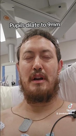tiger snake bite #venomous #dangerious #snakes #hospital #fyp #foryou