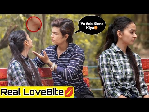 Real Love Bite Prank💋|| Prank On Boyfriend (Gone Extremely Wrong😱) || Shahfaiz World