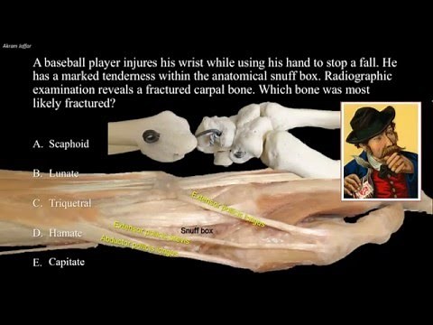 Tenderness at the anatomical snuff box