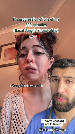 Understanding Catatonia: Causes and ECT Treatment