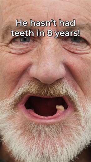 8.1K views · 46 reactions | This guy hasn't had teeth in 8 YEARS! 勞...