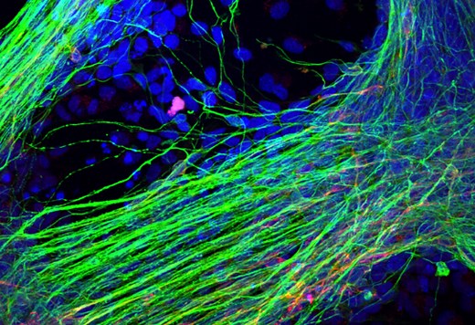 Cellules souches pluripotentes induites (IPS) · Inserm, La science pour la santé
