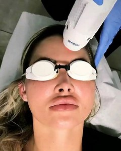 20 reactions | #NeoClearbyAerolase is the most advanced treatment for...