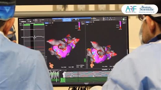 ARF MEDICAL on Instagram: "La semana pasada se realizó el primer procedimiento con FARAPULSE™ en el Hospital Muguerza Alta Especialidad. Se llevó a cabo una ablación de fibrilación auricular utilizando FARAPULSE™, un sistema de ablación por campo pulsado que, a diferencia de las técnicas térmicas tradicionales, emplea pulsos eléctricos rápidos y controlados para actuar de forma selectiva sobre el tejido responsable de la arritmia, preservando estructuras adyacentes como el esófago y los nervios.