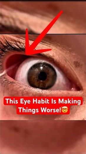 Why You Should Never Pull Mucus Out of Your Eye