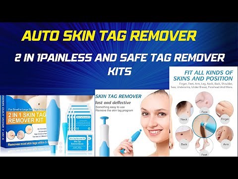 Auto Skin Tag Remover, 2 in 1Painless and Safe Tag Remover Kit